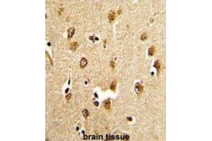 Immunohistochemistry (IHC) image for anti-Abl-Interactor 1 (ABI1) antibody (ABIN3003792) (ABI1 抗体)