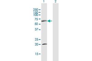 Western Blot analysis of SDPR expression in transfected 293T cell line by SDPR MaxPab polyclonal antibody. (SDPR 抗体  (AA 1-425))
