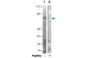 Western blot analysis of extracts from HT-29 cells, using CDC6 polyclonal antibody . (CDC6 抗体)