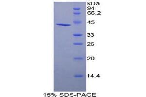 SDS-PAGE analysis of Human uPAR Protein. (PLAUR 蛋白)