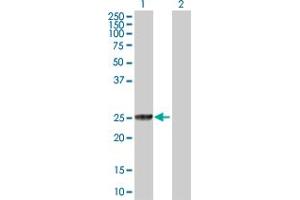 Western Blot analysis of GSTT2 expression in transfected 293T cell line by GSTT2 MaxPab polyclonal antibody. (GSTT2 抗体  (AA 1-244))