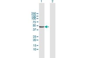 Western Blot analysis of KRT20 expression in transfected 293T cell line by KRT20 MaxPab polyclonal antibody. (KRT20 抗体  (AA 1-424))