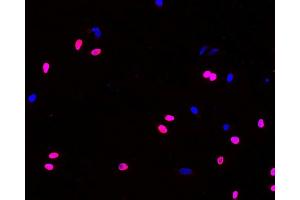 Immunofluorescence analysis of Hela cells(treated with 0. (BrdU 抗体)