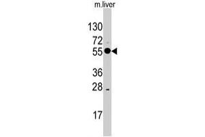 Western blot analysis of ALDH8A1 polyclonal antibody  in mouse liver tissue lysates (35 ug/lane). (ALDH8A1 抗体  (C-Term))