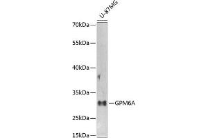 Western blot analysis of extracts of U-87MG cells, using GPM6A antibody (ABIN6134764, ABIN6141338, ABIN6141340 and ABIN6224880) at 1:1000 dilution. (GPM6A 抗体  (AA 1-100))