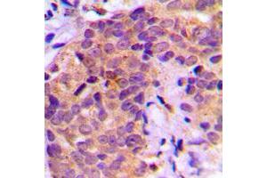 Immunohistochemistry (IHC) image for anti-BCL2-Associated Agonist of Cell Death (BAD) (pSer136) antibody (ABIN7299098)