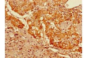 Immunohistochemistry of paraffin-embedded human adrenal gland tissue using ABIN7153725 at dilution of 1:100 (GFRA3 抗体  (AA 32-236))