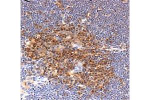 Immunohistochemical staining in mouse thymus with PFN1 polyclonal antibody . (PFN1 抗体  (AA 100-140))