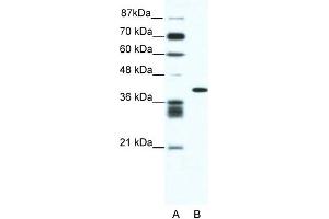 WB Suggested Anti-ALX4 Antibody Titration: 0. (ALX4 抗体  (N-Term))
