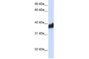 CLN8 antibody used at 1 ug/ml to detect target protein. (CLN8 抗体)