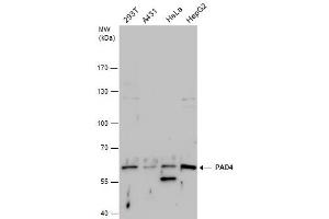WB Image PAD4 antibody detects PAD4 protein by western blot analysis.