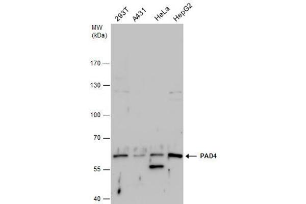 PAD4 antibody  (Center)