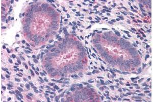 Human Uterus: Formalin-Fixed, Paraffin-Embedded (FFPE) (ELP3/KAT9 抗体  (AA 240-445))