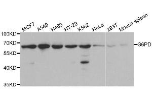 Western blot analysis of extracts of various cell lines, using G6PD antibody. (Glucose-6-Phosphate Dehydrogenase 抗体  (AA 246-545))