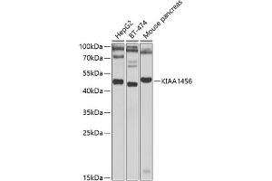 Western blot analysis of extracts of various cell lines, using KI antibody (ABIN6132140, ABIN6142847, ABIN6142849 and ABIN6223016) at 1:1000 dilution. (KIAA1456 抗体  (AA 110-330))