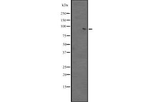 Western blot analysis of BACH2 expression in A431 whole cell lysate ,The lane on the left is treated with the antigen-specific peptide.