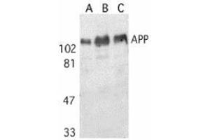Western blot analysis of APP in human (A), mouse (B), and rat (C) brain tissue lysates with AP30070PU-N APP antibody at 1 μg/ml. (APP 抗体)