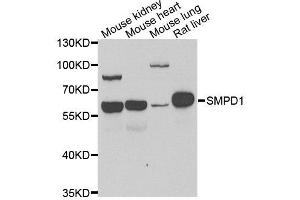 SMPD1 抗体  (AA 70-340)