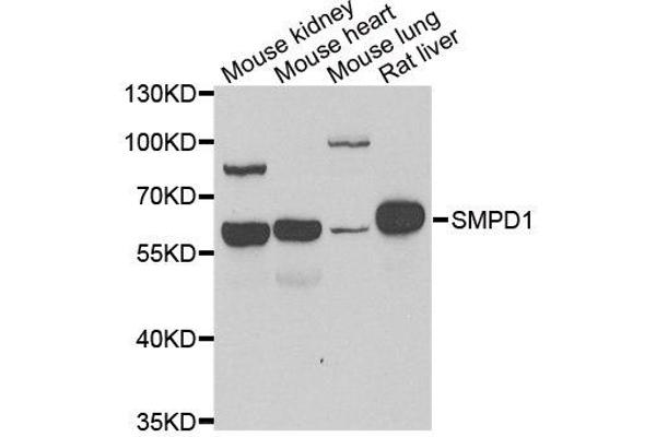 SMPD1 抗体  (AA 70-340)