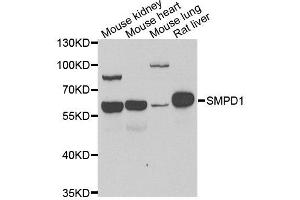 Western blot analysis of extracts of various cell lines, using SMPD1 antibody. (SMPD1 抗体  (AA 70-340))