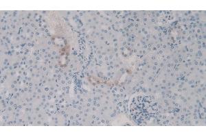 Detection of C4a in Mouse Kidney Tissue using Polyclonal Antibody to Complement Component 4a (C4a) (C4A 抗体)