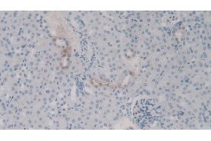 Detection of C4a in Mouse Kidney Tissue using Polyclonal Antibody to Complement Component 4a (C4a) (C4A 抗体)