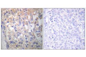 Immunohistochemistry (IHC) image for anti-FYN Oncogene Related To SRC, FGR, YES (FYN) (pTyr530) antibody (ABIN1847258) (FYN 抗体  (pTyr530))