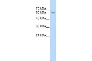 WB Suggested Anti-SARDH Antibody Titration: 2. (SARDH 抗体  (Middle Region))