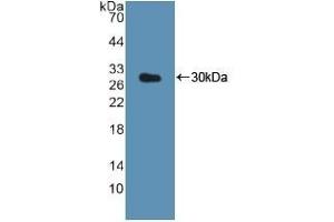 Detection of Recombinant CTSK, Human using Polyclonal Antibody to Cathepsin K (CTSK) (Cathepsin K 抗体  (AA 54-317))