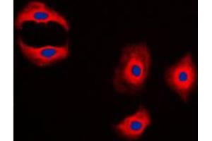 Immunofluorescent analysis of MMP3 staining in A431 cells. (MMP3 抗体  (C-Term))