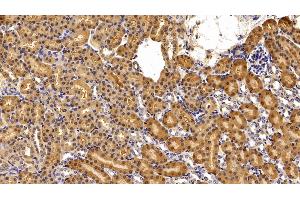 Immunohistochemistry (IHC) image for anti-Superoxide Dismutase 1, Soluble (SOD1) (AA 2-154) antibody (ABIN7429211)