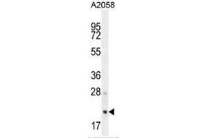 AP3S1 Antibody (N-term) western blot analysis in A2058 cell line lysates (35µg/lane). (AP3S1 抗体  (N-Term))