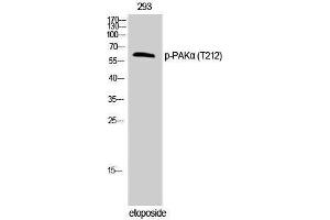 Western Blotting (WB) image for anti-P21-Activated Kinase 1 (PAK1) (pThr212) antibody (ABIN3182552) (PAK1 抗体  (pThr212))