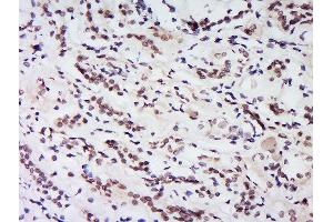 Formalin-fixed and paraffin embedded human kidney labeled with Rabbit Anti-HS1BP3 Polyclonal Antibody, Unconjugated  at 1:200 followed by conjugation to the secondary antibody and DAB staining. (HS1BP3 抗体  (AA 51-130))