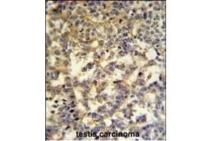 G6PD Antibody (Center) (ABIN651286 and ABIN2840171) IHC analysis in formalin fixed and paraffin embedded testis followed by peroxidase conjugation of the secondary antibody and DAB staining. (Glucose-6-Phosphate Dehydrogenase 抗体  (AA 297-326))