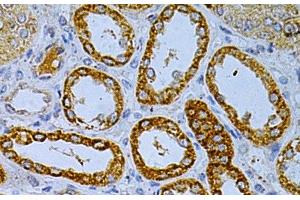 Immunohistochemistry of paraffin-embedded Human kidney using OLR1 Polyclonal Antibody at dilution of 1:200 (40x lens). (OLR1 抗体)