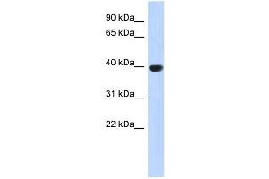 AURKC antibody used at 1 ug/ml to detect target protein. (Aurora Kinase C 抗体  (Middle Region))