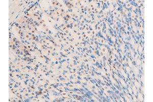 ABIN6267283 at 1/100 staining mouse gastric tissue sections by IHC-P. (ErbB2/Her2 抗体  (pTyr1248))