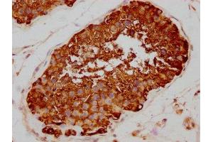 Immunohistochemistry (IHC) image for anti-HSP9AA1 antibody (ABIN7127552)