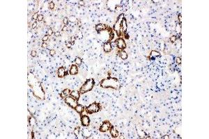 Anti-Glucose Transporter 5 GLUT5 antibody, IHC(P) IHC(P): Rat Kidney Tissue (SLC2A5 抗体  (Middle Region))