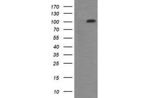Image no. 6 for anti-DEAD (Asp-Glu-Ala-Asp) Box Polypeptide 58 (DDX58) antibody (ABIN1500708) (DDX58 抗体)