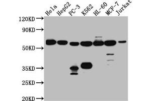 Western Blot Positive WB detected in: Hela whole cell lysate, HepG2 whole cell lysate, PC-3 whole cell lysate, K562 whole cell lysate, HL-60 whole cell lysate, MCF-7 whole cell lysate, Jurkat whole cell lysate All lanes: PTBP1 antibody at 1:1000 Secondary Goat polyclonal to rabbit IgG at 1/50000 dilution Predicted band size: 58, 60, 60 kDa Observed band size: 58 kDa (Recombinant PTBP1 抗体)