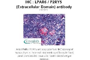 Image no. 1 for anti-Lysophosphatidic Acid Receptor 6 (LPAR6) (2nd Extracellular Domain) antibody (ABIN1736531) (LPAR6 抗体  (2nd Extracellular Domain))