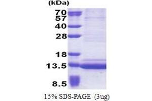 SDS-PAGE (SDS) image for Epithelial Mitogen (EPGN) (AA 23-110) protein (His tag) (ABIN5853246) (Epigen Protein (AA 23-110) (His tag))