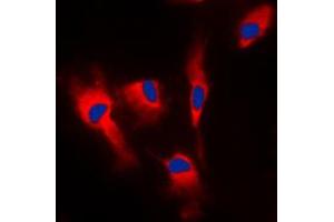 Immunofluorescent analysis of Calmodulin staining in MCF7 cells. (Calmodulin 1 抗体  (Center))