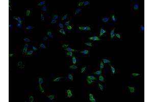 Immunofluorescence staining of MCF-7 cells with ABIN7174974 at 1:100, counter-stained with DAPI.