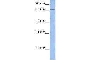 Human MCF-7; WB Suggested Anti-ACSL1 Antibody Titration: 0. (ACSL1 抗体  (N-Term))