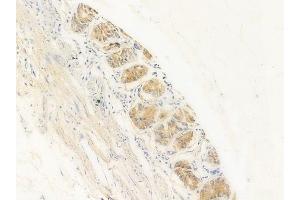 ABIN6256040 and ABIN6267417 at 1/100 staining human normal gastric tissue by IHC-P.