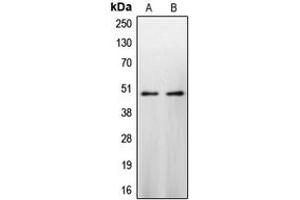 Western blot analysis of Caspase 9 expression in HeLa (A), NIH3T3 (B) whole cell lysates. (Caspase 9 抗体  (Center))