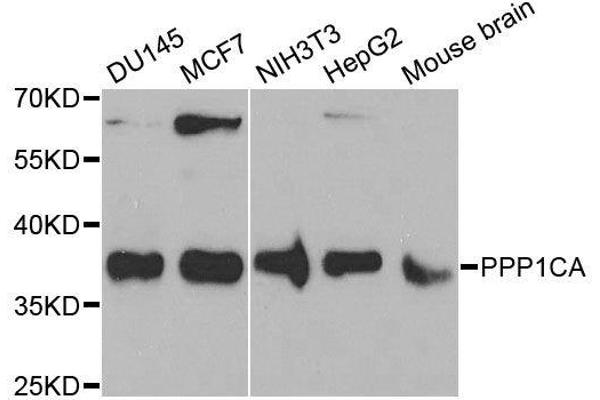 PPP1CA 抗体  (AA 1-330)